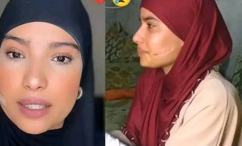 حملة تضامن واسعة مع الفتاة سلمى ضحية الاعتداء من طرف زميلتها