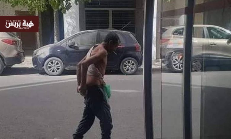 نقل طفل إلى مستعجلات فاس بعد اعتداء بحجر من مختل عقلي بتازة